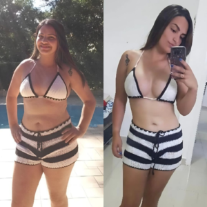 Emagretirze na Emagrecentro Diadema